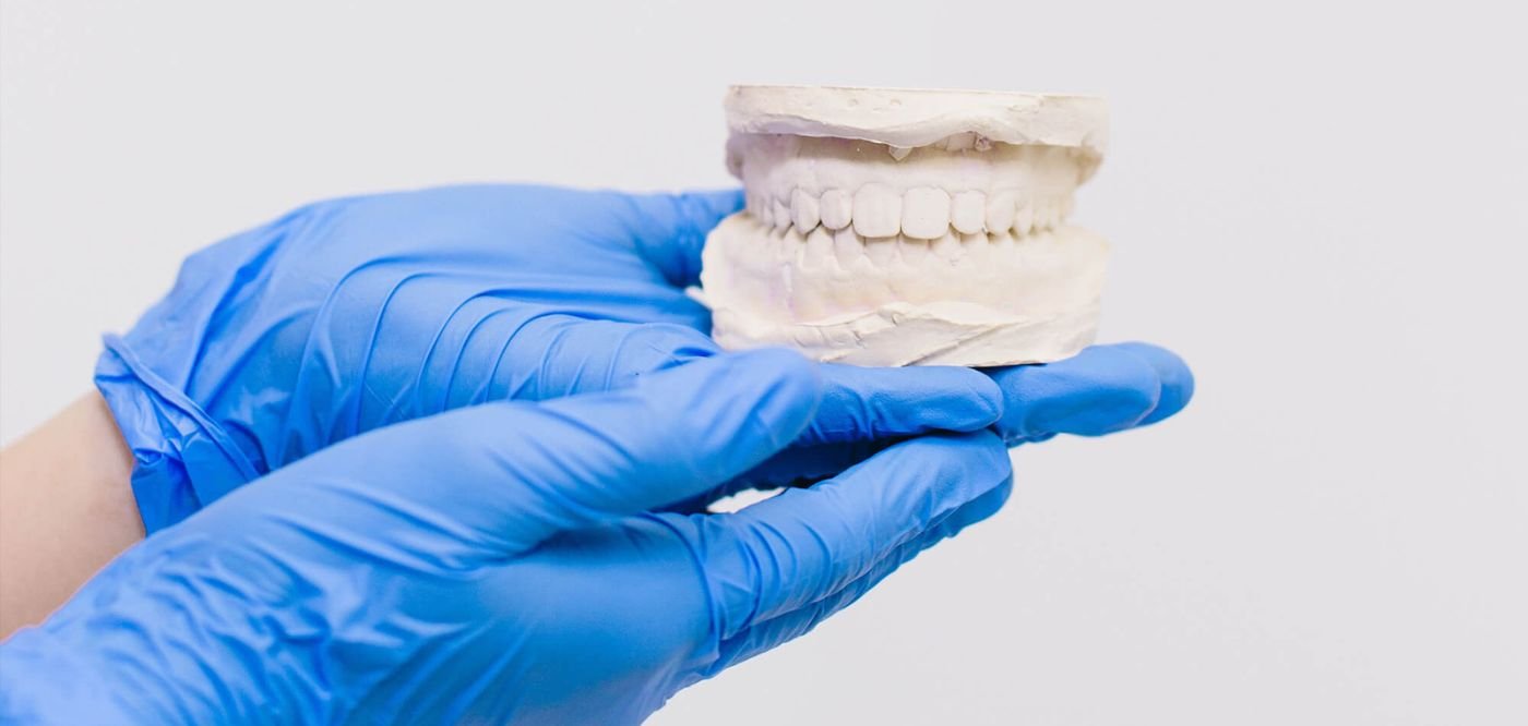 Dantų Protezavimas